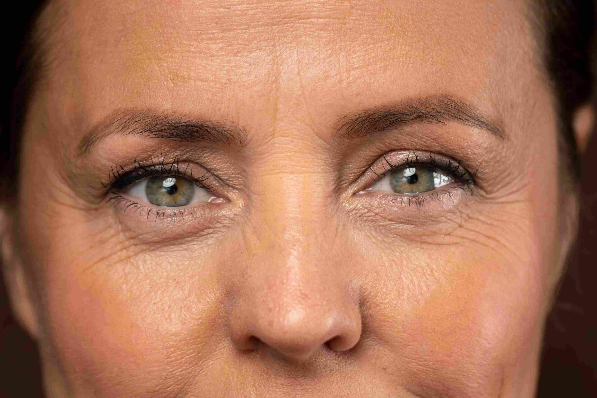 Eyelid Surgery Before and After: What to Expect