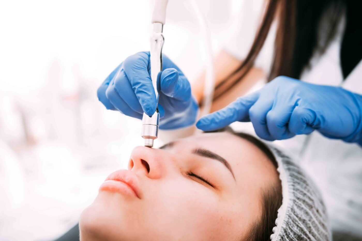 Microdermabrasion Vs Chemical Peel | Your Best Choice!